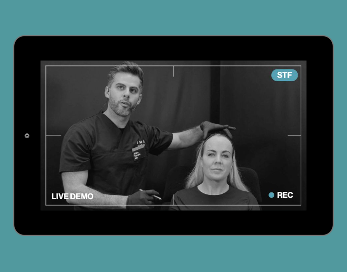 Live Demonstration | middle third | non surgical rhinoplasty