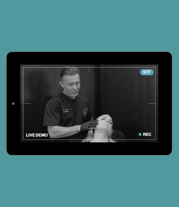 Live Demonstration | middle third | cheek augmentation - needle - hybrid CaHA / HA periosteum