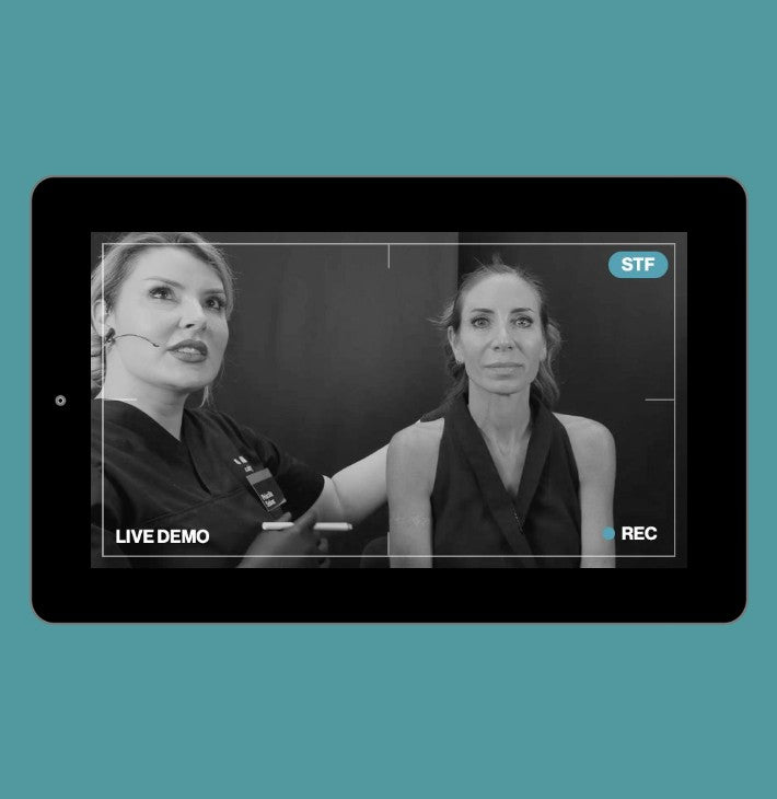 Live Demonstration | middle third | lip augmentation - needle - vertical flat lips - HA