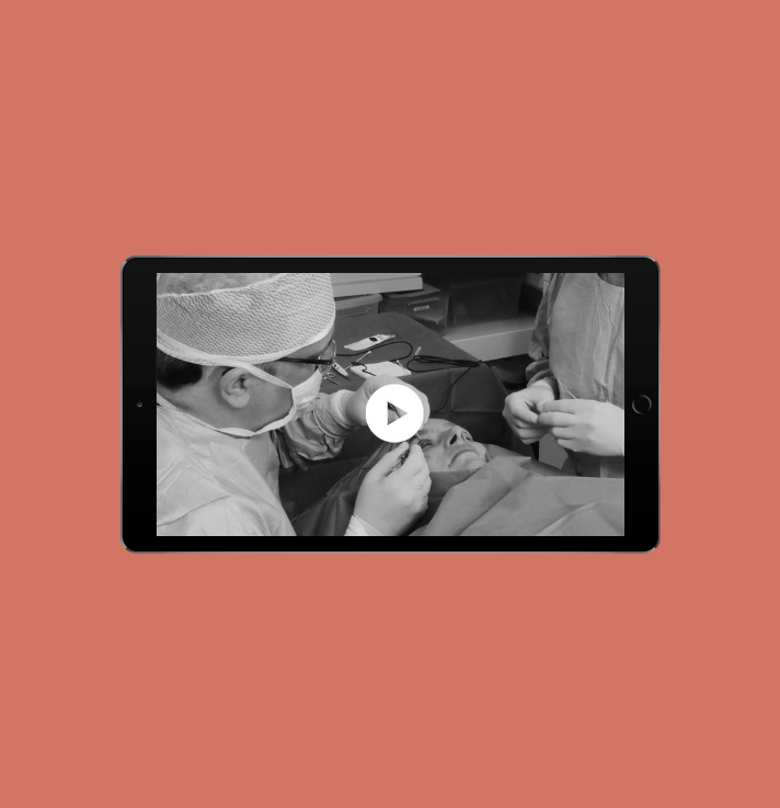 oculoplastic surgery | blepharoplasty upper eyelids