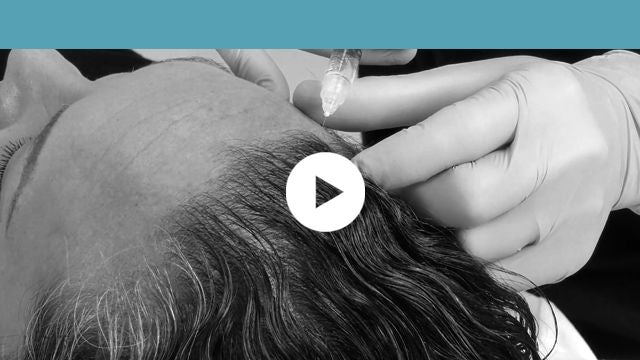 non-facial indications | scalp