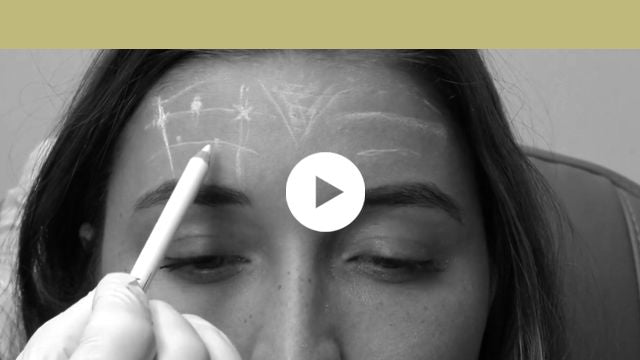 facial indications | upper third - horizontal forehead lines