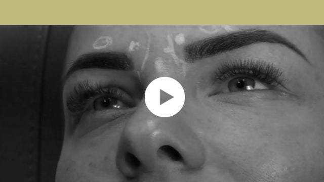 facial indications | upper third - glabella