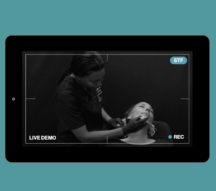 Live Demonstration | lower third | neck - skin quality improvement - CaHA, cannula