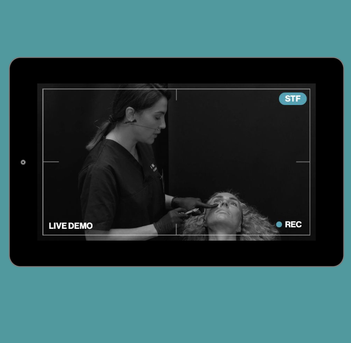 Live Demonstration | lower third | radial liplines, lip contour, pre-jowl sulcus & mental crease - HA, cannula & needle