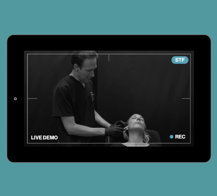 Live Demonstration | lower third | mandibular angle & pre-jowl sulcus - CaHA, needle & cannula