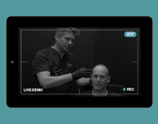 Live Demonstration | middle third | cheek - CaHA, cannula