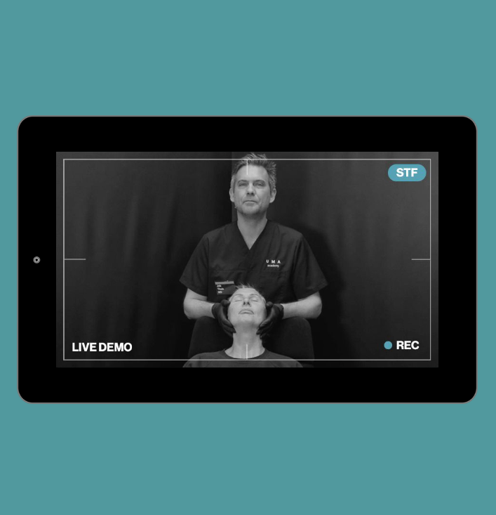 Live Demonstration | upper third | supraorbital sulcus & hollow eye cannula