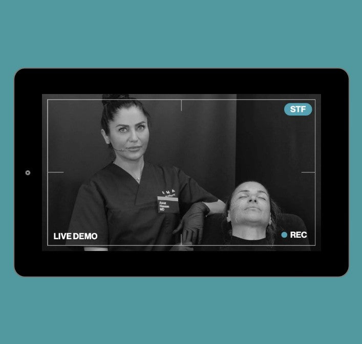 Live Demonstration | middle third | cheeks - CaHA, HA, cannula