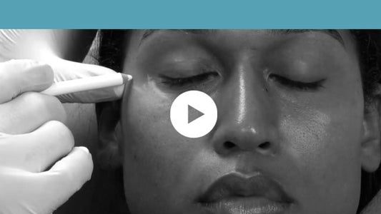 facial indications | middle third - palpebromalar groove