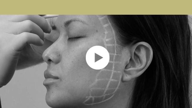 skin quality improvement | microtoxin injections for facial lifting