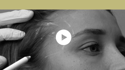 facial indications | upper third - tension headache and migraine