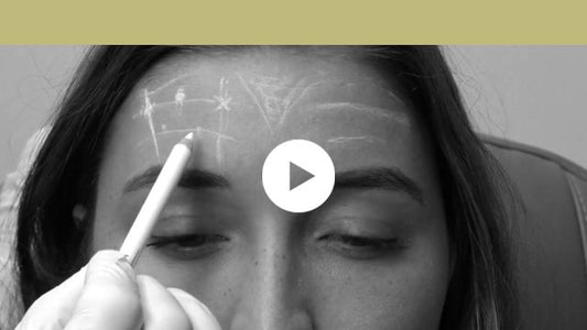 facial indications | upper third - horizontal forehead lines