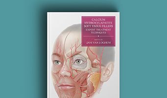 calcium hydroxylapatite soft tissue fillers expert treatment techniques