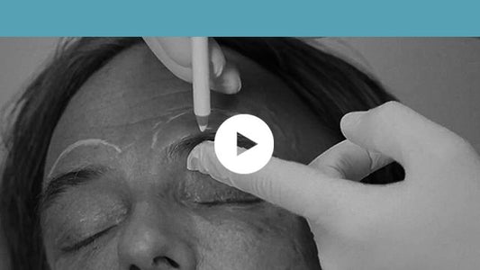 facial indications | upper third - frontal concavity and frontal bossing in men