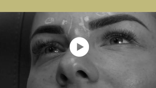 facial indications | upper third - glabella