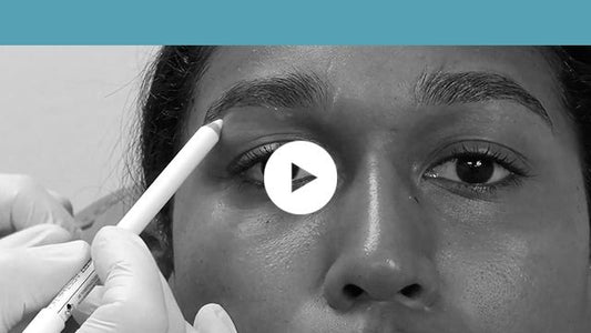 facial indications | upper third - brows