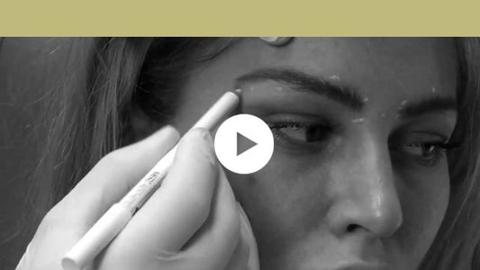 facial indications | upper third - brow lift