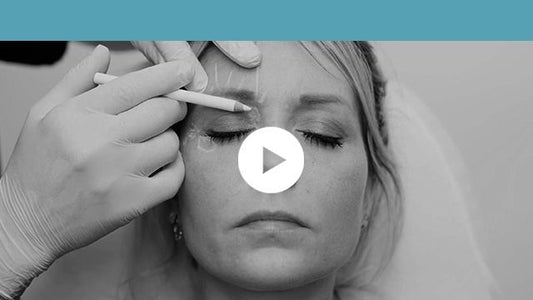 facial indications | upper third - superior orbital sulcus