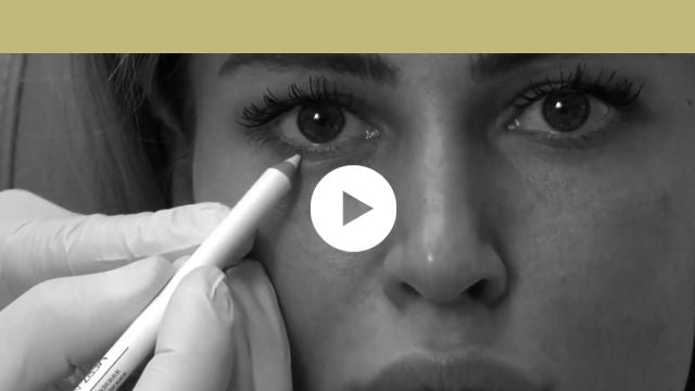 facial indications | upper third - lower eyelid wrinkles and widening of the eyes