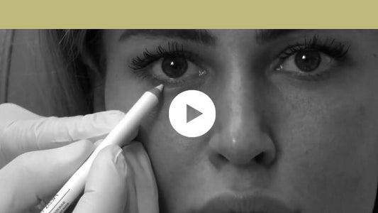 facial indications | upper third - lower eyelid wrinkles and widening of the eyes