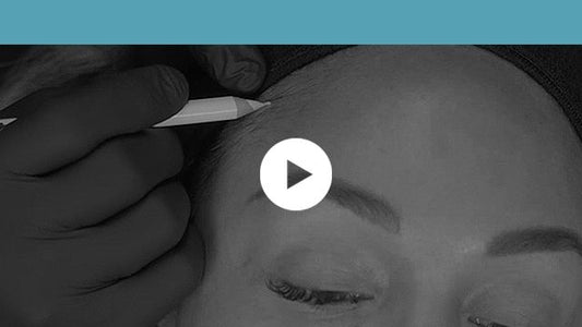 facial indications | upper third - forehead lift